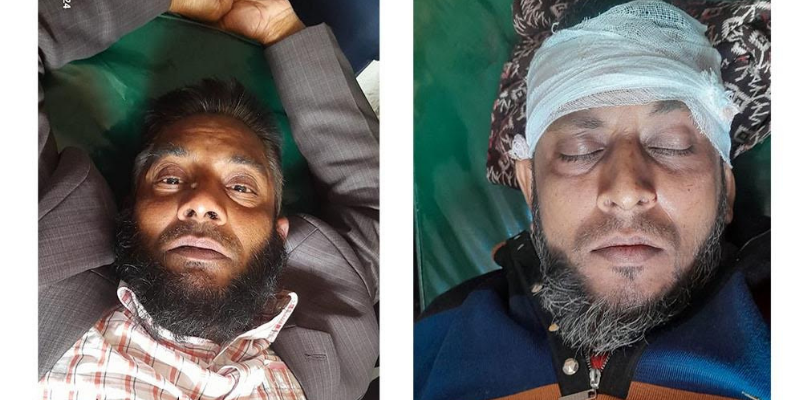 মঠবাড়িয়ায় জমি সংক্রান্ত বিরোধে সংঘর্ষ, যুব উন্নয়ন কর্মকর্তাকে হাতুড়িপেটা