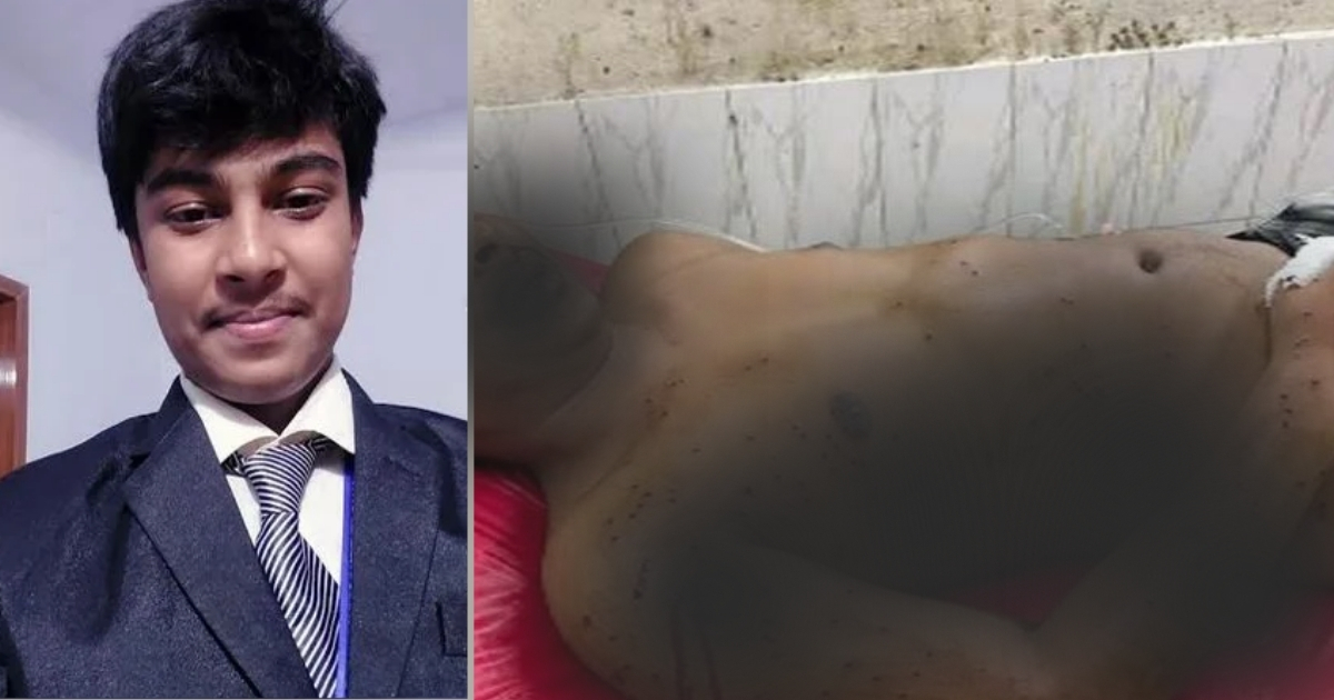 শরীরে এখনও ১৫০টি গুলি বয়ে বেড়াচ্ছেন মুন