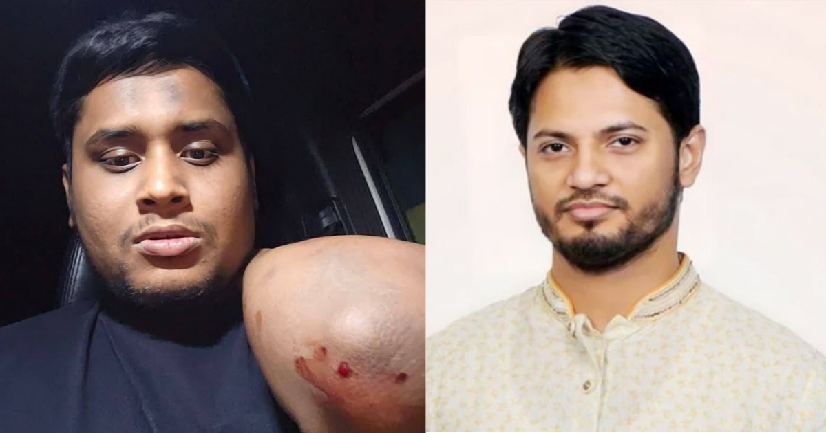 হাসনাতের ওপর হামলা, শিবির সভাপতির রুখে দেওয়ার হুঁশিয়ারি