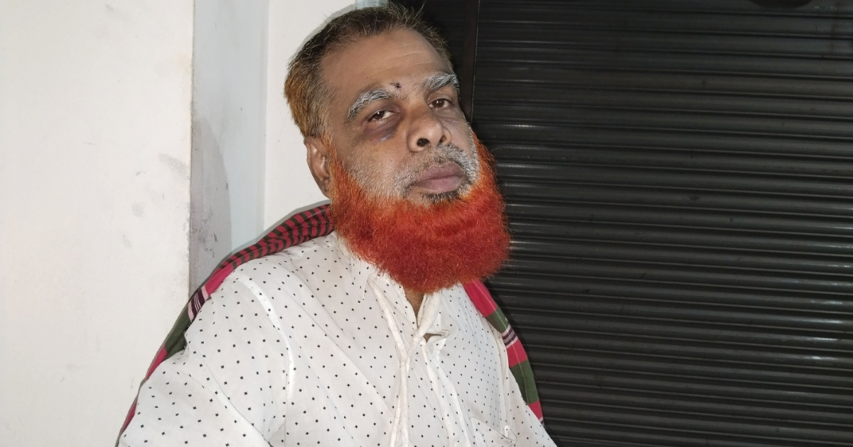 দেলদুয়ার লাউহাটিতে জমি সংক্রান্ত বিরোধে হামলায় আহত ৩