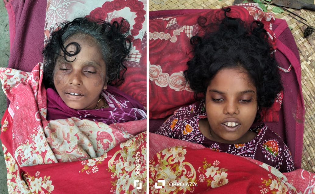 এনজিও’র ঋণের চাপ ও অভাবে কুমিল্লার বুড়িচংয়ে মা-মেয়ের আত্মহত্যা