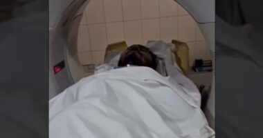 মাথায় ব্যাপক রক্তক্ষরণের কারণে আবারও সিটি স্ক্যান করানো হলো নুরের
