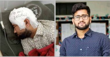 মামুনের খুলি ফ্রিজে, মাথার ব্যান্ডেজ লেখা ‘হাড় নেই, চাপ দিবেন না’