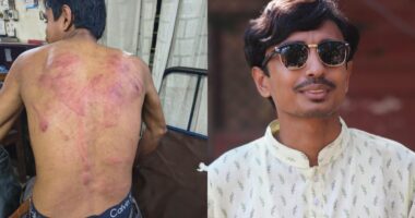 অতর্কিত হামলায় ছাত্র অধিকার পরিষদের নেতা গুরুতর আহত