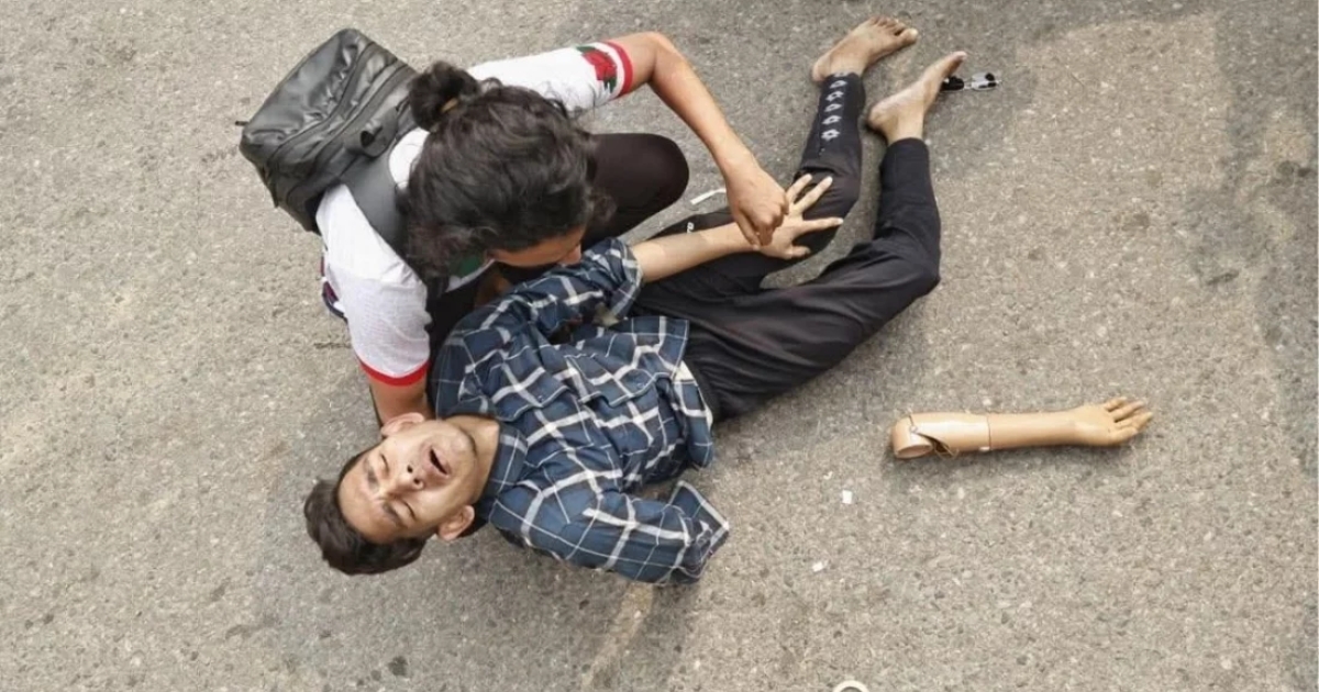 পুলিশের লাঠিচার্জে খুলে গেল জুলাই যোদ্ধার কৃত্রিম হাত