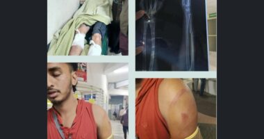 কানাইঘাটে ব্যাডমিন্টন খেলার সময় ২ জনের ওপর অতর্কিত হামলা ,গুরুতর আহত হয়ে হাসপাতালে ভর্তি