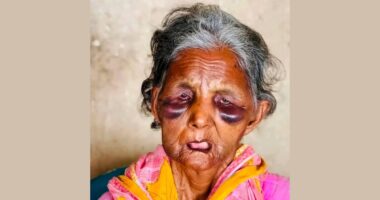 লুটপাটের শিকার হওয়া বাকপ্রতিবন্ধী বুবির মৃত্যু