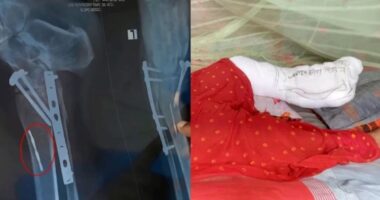 মেশিনের ফলা রেখে রোগীর পায়ে সেলাইয়ের ঘটনা তদন্তে কমিটি গঠন