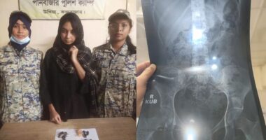 ‎পেটে করে ইয়াবা পাচার,৮ এপিবিএনের অভিযানে ইয়াবাসহ নারী আটক