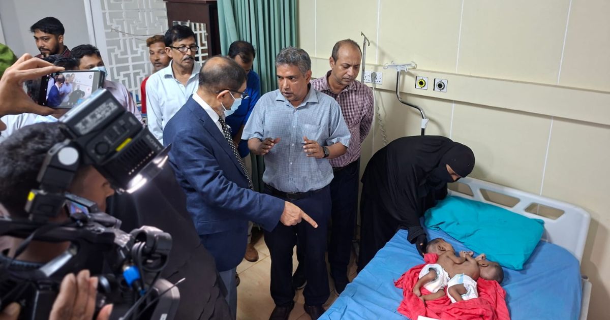 পেট জোড়া লাগানো ২ শিশুকে দেখতে গেলেন স্বাস্থ্যমন্ত্রী, চিকিৎসা শুরু সরকারি খরচে