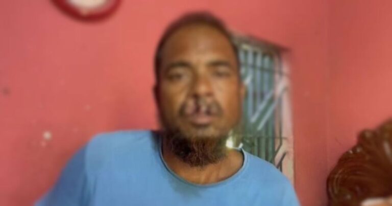 বিএনপি নেতার দাঁত ভেঙে দিলেন আ.লীগ সমর্থকরা