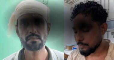 সিলেট ওসমানী মেডিকেল কলেজ হাসপাতালে রোগীর স্বজন ও ইন্টার্ন চিকিৎসকদের সংঘর্ষ, ২ সাংবাদিক আহত